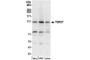 Western Blotting (WB) image for anti-Tudor Domain Containing 7 (TDRD7) (AA 1048-1098) antibody (ABIN7452979)