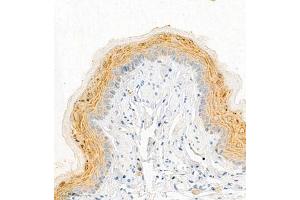 Immunohistochemistry of paraffin embedded rat esophagus using SPRR3 (ABIN7075637) at dilution of 1:2000 (300x lens)