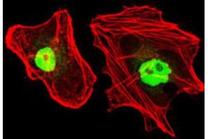 Immunofluorescence analysis of HeLa cells using RPA1 antibody (green). (RPA1 抗体)