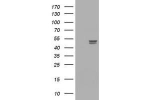 Image no. 1 for anti-Thymidine Phosphorylase (TYMP) (AA 311-482) antibody (ABIN1491393)