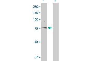 Western Blotting (WB) image for anti-Solute Carrier Family 5 (Sodium/glucose Cotransporter), Member 1 (SLC5A1) (AA 1-664) antibody (ABIN520242)