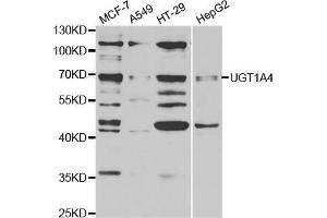 Western blot analysis of extracts of various cell lines, using μgT1A4 antibody (ABIN5973231) at 1/1000 dilution. (UGT1A4 抗体)