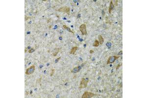 Immunohistochemistry of paraffin-embedded mouse spinal cord using TXN2 antibody. (TXN2 抗体)