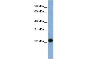 WB Suggested Anti-CAV1 Antibody Titration:  0. (Caveolin-1 抗体  (N-Term))