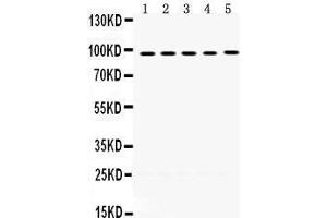 Western Blotting (WB) image for anti-Minichromosome Maintenance Deficient 8 (MCM8) (AA 809-840), (C-Term) antibody (ABIN3042508) (MCM8 抗体  (C-Term))