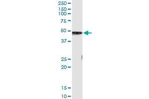 Immunoprecipitation of CPB1 transfected lysate using mouse monoclonal anti-CPB1 and Protein A Magnetic Bead (CPB1 (人) IP-WB Antibody Pair)