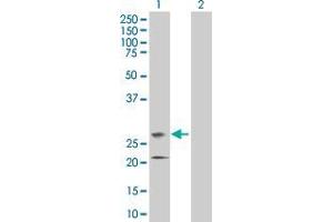 Lane 1: GNPTG transfected lysate ( 31. (GNPTG 293T Cell Transient Overexpression Lysate(Denatured))
