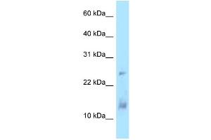 WB Suggested Anti-DYNLL1 Antibody Titration: 1. (DYNLL1 抗体  (Middle Region))