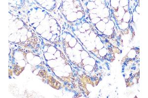 Immunohistochemistry of paraffin-embedded mouse colon using MUC2 Rabbit mAb (ABIN7268689) at dilution of 1:100 (40x lens). (MUC2 抗体)