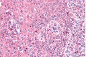 Immunohistochemistry (IHC) image for anti-Guanine Nucleotide Binding Protein (G Protein), alpha Inhibiting Activity Polypeptide 2 (GNAI2) (AA 289-299) antibody (ABIN5539638)