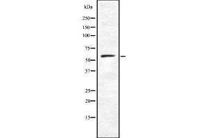 Western blot analysis of CARD9 using K562 whole cell lysates