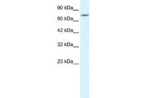 WB Suggested Anti-RIPK1 Antibody Titration:  0. (RIPK1 抗体  (Middle Region))