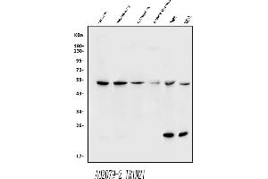 Western blot analysis of TRIM21/SS-A using anti-TRIM21/SS-A antibody (ABIN7599820).