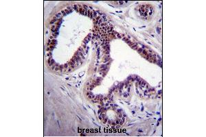 PK8 Antibody (C-term) (ABIN391724 and ABIN2841613) immunohistochemistry analysis in forlin fixed and paraffin embedded hun breast tissue followed by peroxidase conjugation of the secondary antibody and DAB staining. (JNK 抗体  (C-Term))