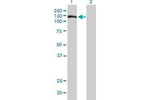 Western Blot analysis of TMEM1 expression in transfected 293T cell line by TMEM1 monoclonal antibody (M01), clone 5B4. (TRAPPC10 抗体  (AA 1162-1257))