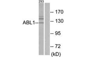 Western blot analysis of extracts from 293 cells, using ABL1 Antibody. (ABL1 抗体  (AA 861-910))