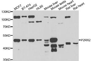 Western blot analysis of extracts of various cell lines, using P2RX2 antibody (ABIN5975474) at 1/1000 dilution. (P2RX2 抗体)