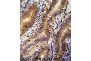 ANGPT2 antibody (C-term) immunohistochemistry analysis in formalin fixed and paraffin embedded human uterus tissue followed by peroxidase conjugation of the secondary antibody and DAB staining. (Angiopoietin 2 抗体  (C-Term))