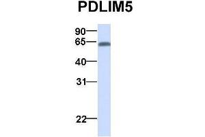 Host:  Rabbit  Target Name:  PDLIM5  Sample Type:  Human Adult Placenta  Antibody Dilution:  1. (PDLIM5 抗体  (N-Term))