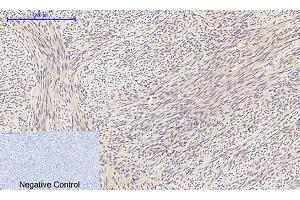 Immunohistochemical analysis of paraffin-embedded human uterus tissue. (EIF2A 抗体)
