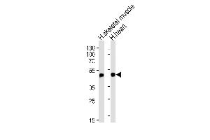Western blot analysis of lysates from human skeletal muscle and heart tissue lysates (from left to right), using HFE2 Antibody (Center) (ABIN653653 and ABIN2842994).
