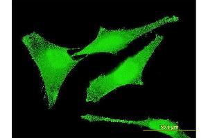 Immunofluorescence of monoclonal antibody to SET on HeLa cell. (SET/TAF-I 抗体  (AA 1-277))