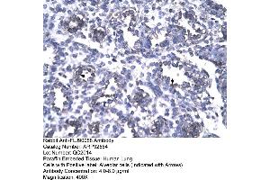 Human Lung (FOXP1 抗体  (N-Term))