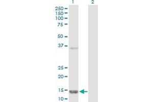 Western Blot analysis of FABP5 expression in transfected 293T cell line by FABP5 MaxPab polyclonal antibody. (FABP5 抗体  (AA 1-135))