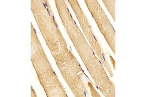 (ABIN6243629 and ABIN6577994) staining CHST1 in Human skeletal muscle tissue sections by Immunohistochemistry (IHC-P - paraformaldehyde-fixed, paraffin-embedded sections). (CHST1 抗体  (C-Term))