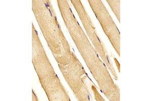 (ABIN6243629 and ABIN6577994) staining CHST1 in Human skeletal muscle tissue sections by Immunohistochemistry (IHC-P - paraformaldehyde-fixed, paraffin-embedded sections). (CHST1 抗体  (C-Term))