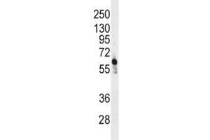Western Blotting (WB) image for anti-6-phosphofructo-2-Kinase/fructose-2,6-Biphosphatase 3 (PFKFB3) (AA 454-484) antibody (ABIN3029823)