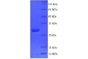 SDS-PAGE (SDS) image for Cathepsin K (CTSK) (AA 115-329) protein (His tag) (ABIN5713386) (Cathepsin K Protein (CTSK) (AA 115-329) (His tag))