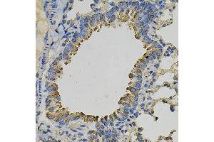 Immunohistochemistry of paraffin-embedded mouse lung using PSAT1 Antibody (ABIN6293473) at dilution of 1:100 (40x lens). (PSAT1 抗体)