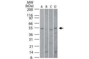Western blot analysis of PIAS4 in (A) human liver, (B) mouse liver, (C) rat liver and (D) human Jurkat lysate using PIAS4 polyclonal antibody  at 5 ug/mL . (PIAS4 抗体  (AA 46-60))