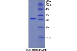 SDS-PAGE analysis of Mouse RUNX2 Protein. (RUNX2 蛋白)