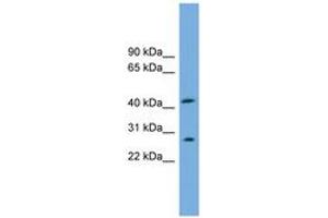 Image no. 1 for anti-Rab9 Effector Protein with Kelch Motifs (RABEPK) (N-Term) antibody (ABIN6744933) (RABEPK 抗体  (N-Term))