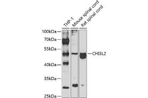 Western blot analysis of extracts of various cell lines, using CHI3L2 antibody (ABIN6132056, ABIN6138529, ABIN6138530 and ABIN6223574) at 1:1000 dilution. (CHI3L2 抗体  (AA 27-390))