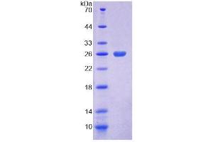 SDS-PAGE analysis of Mouse COASY Protein. (COASY 蛋白)