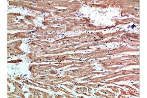 Immunohistochemistry (IHC) image for anti-NLR Family Member X1 (NLRX1) (AA 581-630) antibody (ABIN7184523)