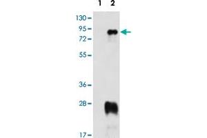 Western blot analysis of PRMT7 (arrow) using PRMT7 polyclonal antibody . (PRMT7 抗体  (N-Term))