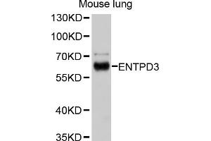 Western blot analysis of extracts of mouse lung, using ENTPD3 antibody (ABIN4903580) at 1:1000 dilution.
