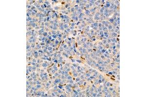 Immunohistochemistry of paraffin embedded mouse myeloma using MNDA (ABIN7074709) at dilution of 1:2000 (400x lens) (MNDA 抗体)