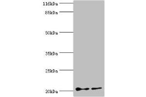 Western blot All lanes: UBE2C antibody at 2 μg/mL Lane 1: Hela whole cell lysate Lane 2: U87 whole cell lysate Secondary Goat polyclonal to rabbit IgG at 1/10000 dilution Predicted band size: 20, 16, 17, 18 kDa Observed band size: 20 kDa (UBE2C 抗体  (AA 2-179))