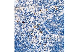 Immunohistochemistry of paraffin embedded mouse spleen using CCL3 (ABIN7073450) at dilution of 1:1000 (400x lens) (CCL3 抗体)