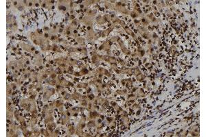 ABIN6262121 and ABIN6277702 at 1/100 staining Human liver tissue by IHC-P. (GSTP1 抗体  (N-Term))