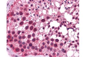 Immunohistochemistry (IHC) image for anti-Kruppel-Like Factor 9 (KLF9) (N-Term) antibody (ABIN2777263) (KLF9 抗体  (N-Term))