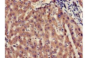 Immunohistochemistry of paraffin-embedded human liver tissue using ABIN7174495 at dilution of 1:100 (UBE2V2 抗体  (AA 2-145))