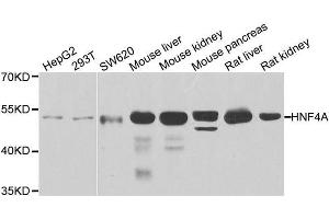 Western blot analysis of extracts of various cell lines, using HNF4A antibody. (HNF4A 抗体  (AA 200-300))