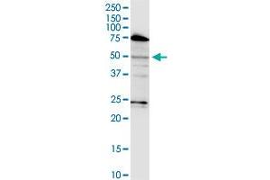 LASS3 monoclonal antibody (M02), clone 6C12. (LASS3 抗体  (AA 57-134))