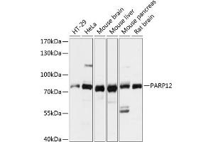 Western blot analysis of extracts of various cell lines, using P antibody (ABIN7269443) at 1:3000 dilution. (PARP12 抗体  (AA 462-701))